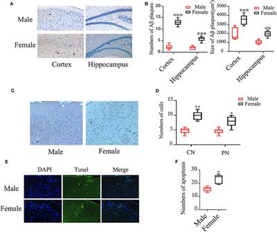 Gender Differences of NLRP1 Inflammasome in Mouse Model of Alzheimer's Disease